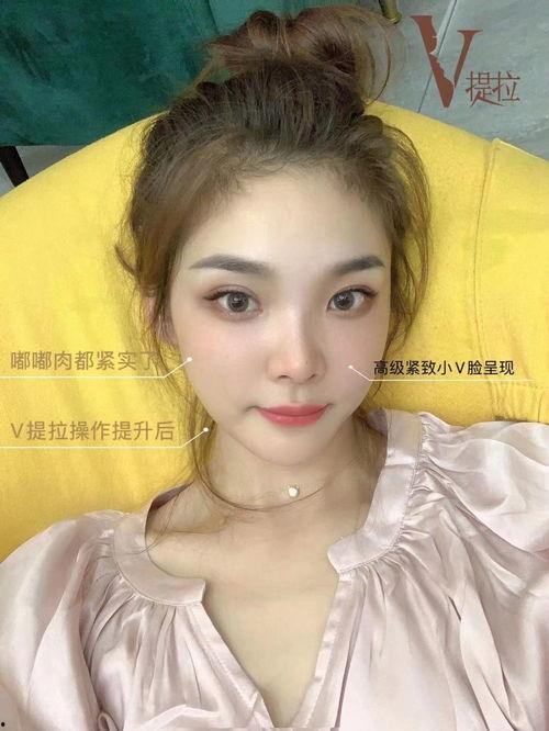 网红打造小v脸